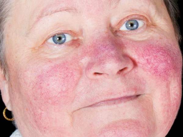 Giải mã nóng mặt theo giờ? Giải mã nóng mặt theo giờ?