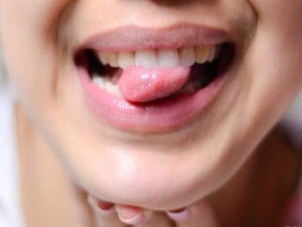 Làm gì khi cắn vào lưỡi