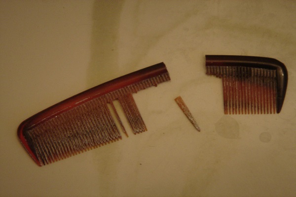 Nguyên nhân dẫn đến lược gãy