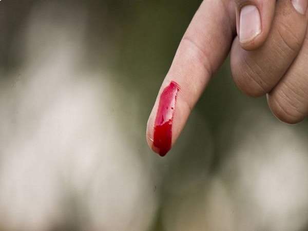 Điềm báo đứt tay