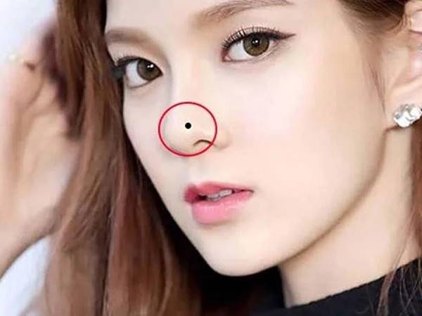 Nốt ruồi xấu ở mũi