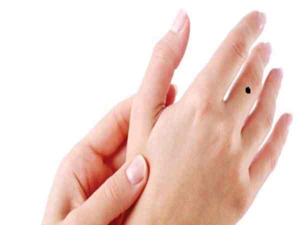 nốt ruồi ngón tay giữa