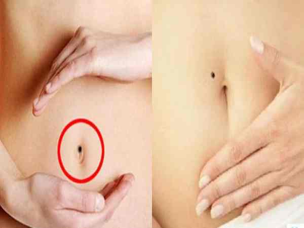 Nốt ruồi ở rốn có ý nghĩa gì trong nhân tướng học Nốt ruồi ở rốn có ý nghĩa gì trong nhân tướng học