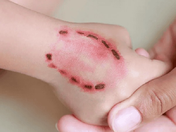 Nằm mơ thấy chó cắn vào tay là điềm gì, có phải xui xẻo?